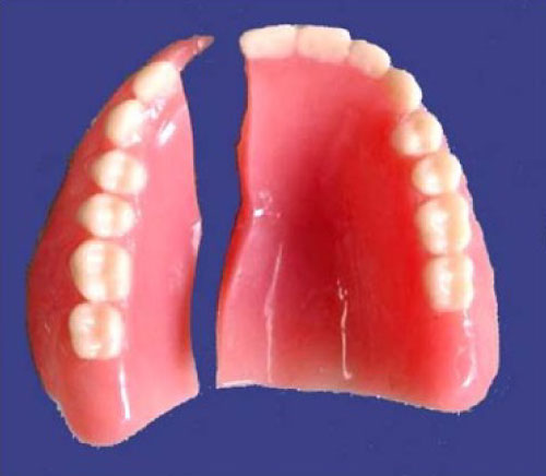 Complete Dentures