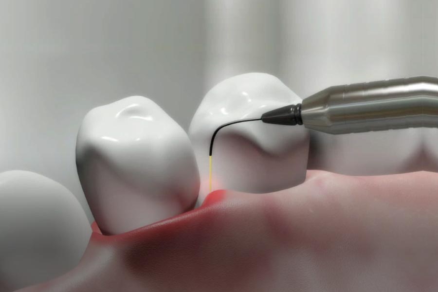 Olympia Laser Dentistry